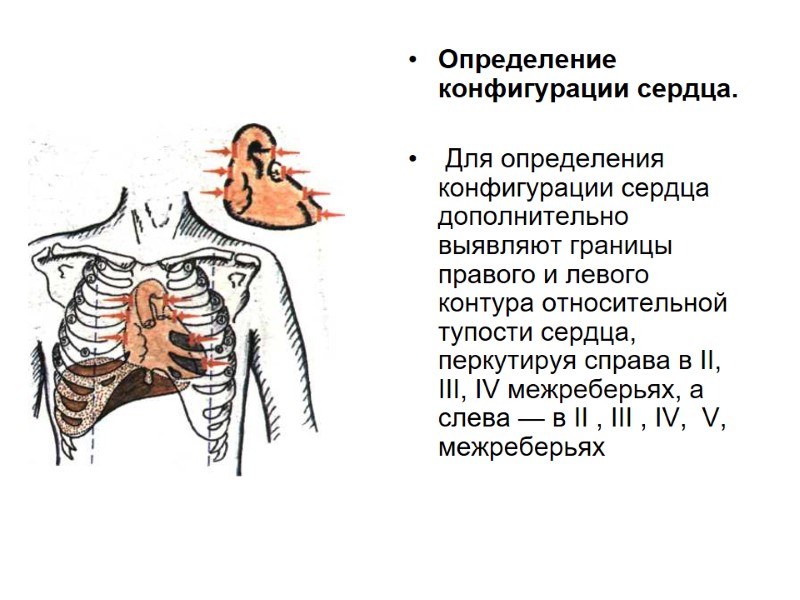 Определение конфигурации сердца.   Для определения конфигурации сердца дополнительно выявляют границы правого и